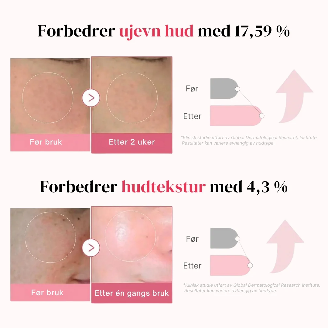 Produktbilde 8
