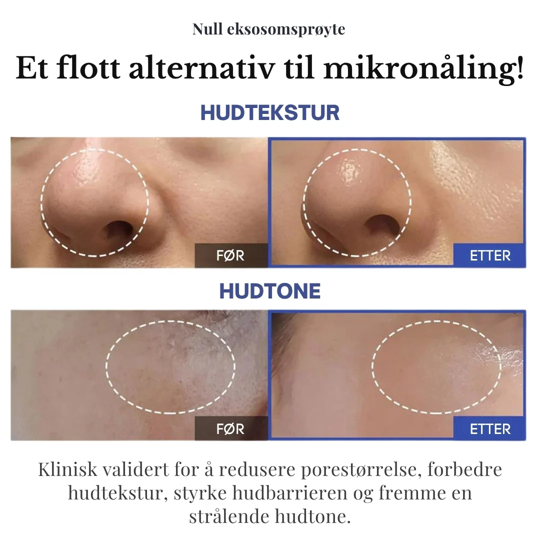 Produktbilde 9