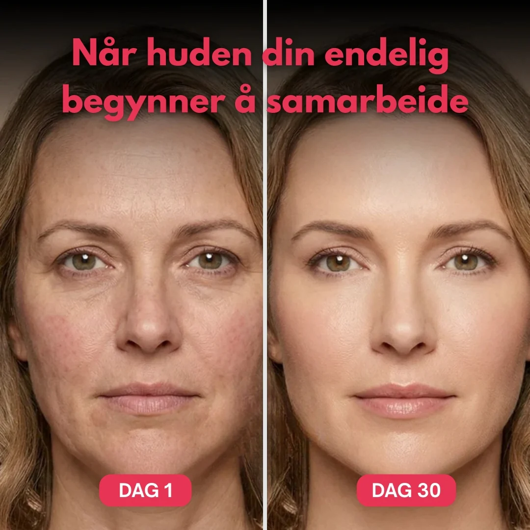 Produktbilde 3