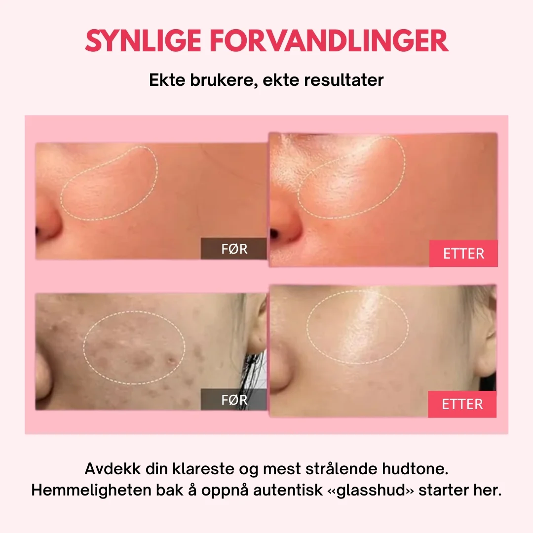 Produktbilde 5