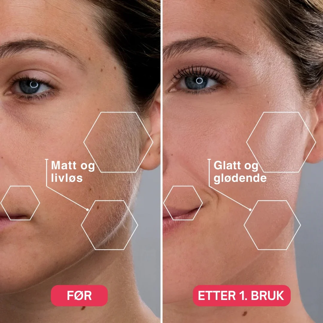 Produktbilde 2