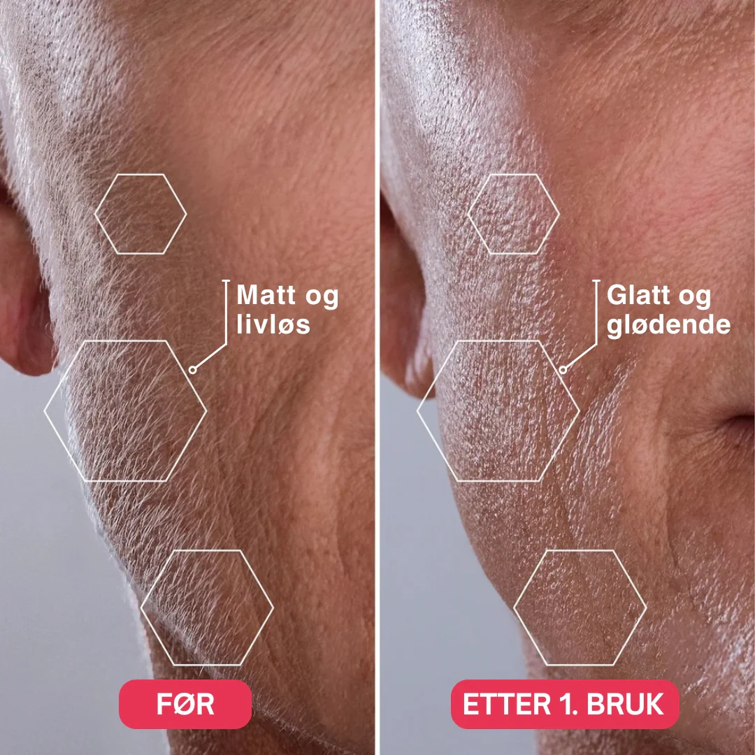 Produktbilde 8