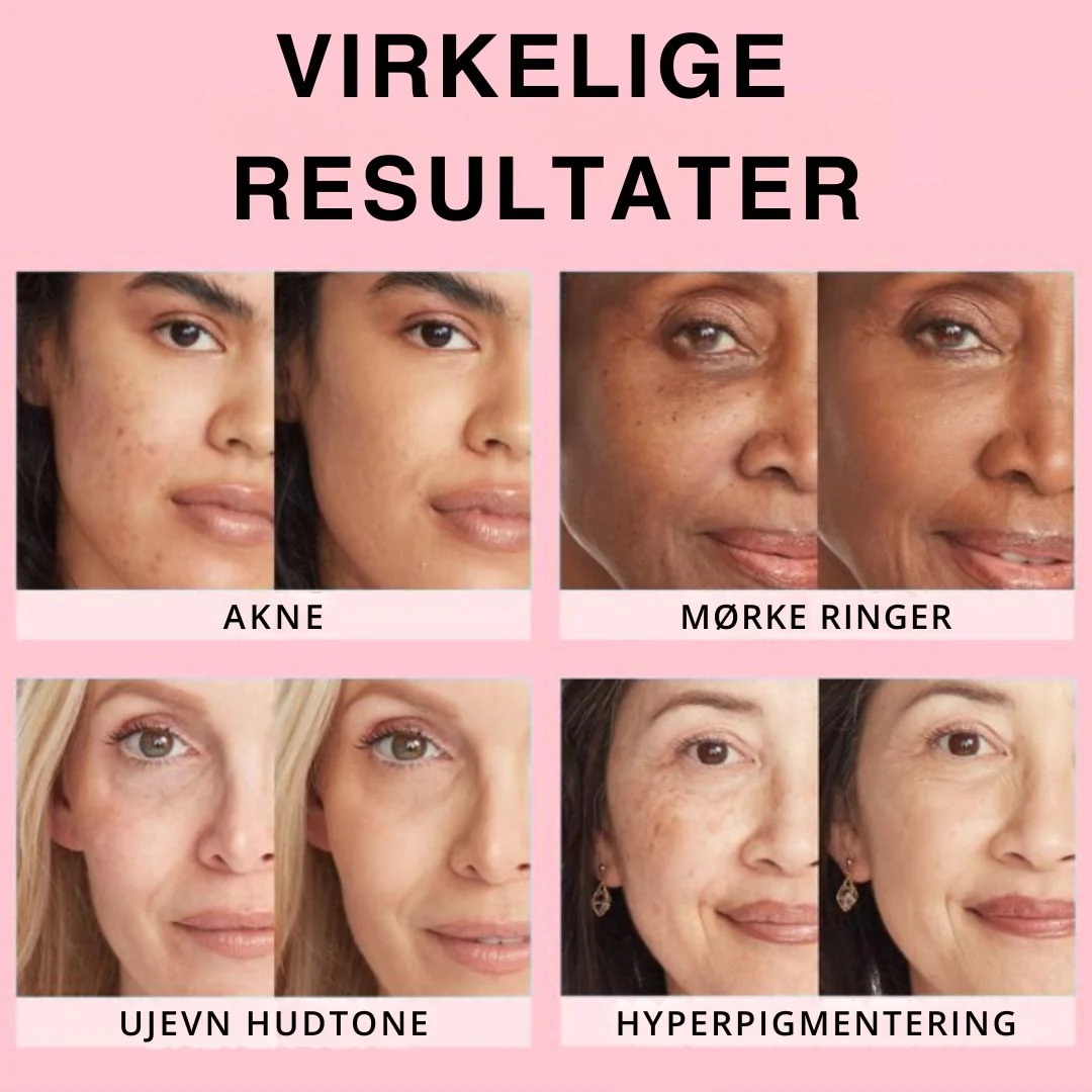 Produktbilde 8