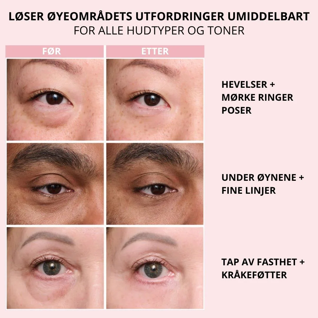 Produktbilde 9