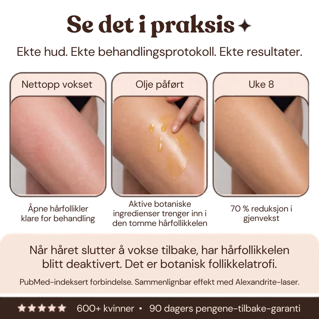 Produktbilde 5