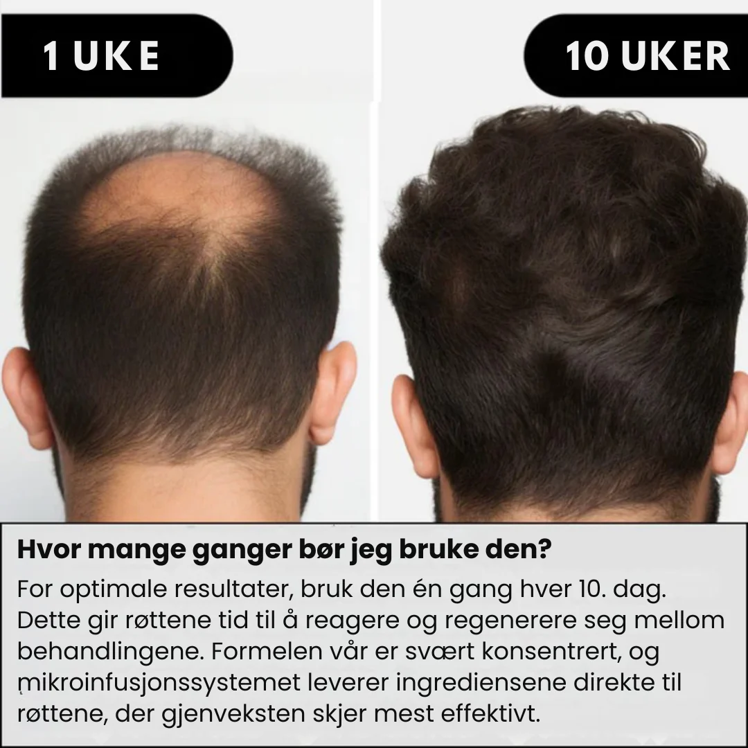 Produktbilde 3