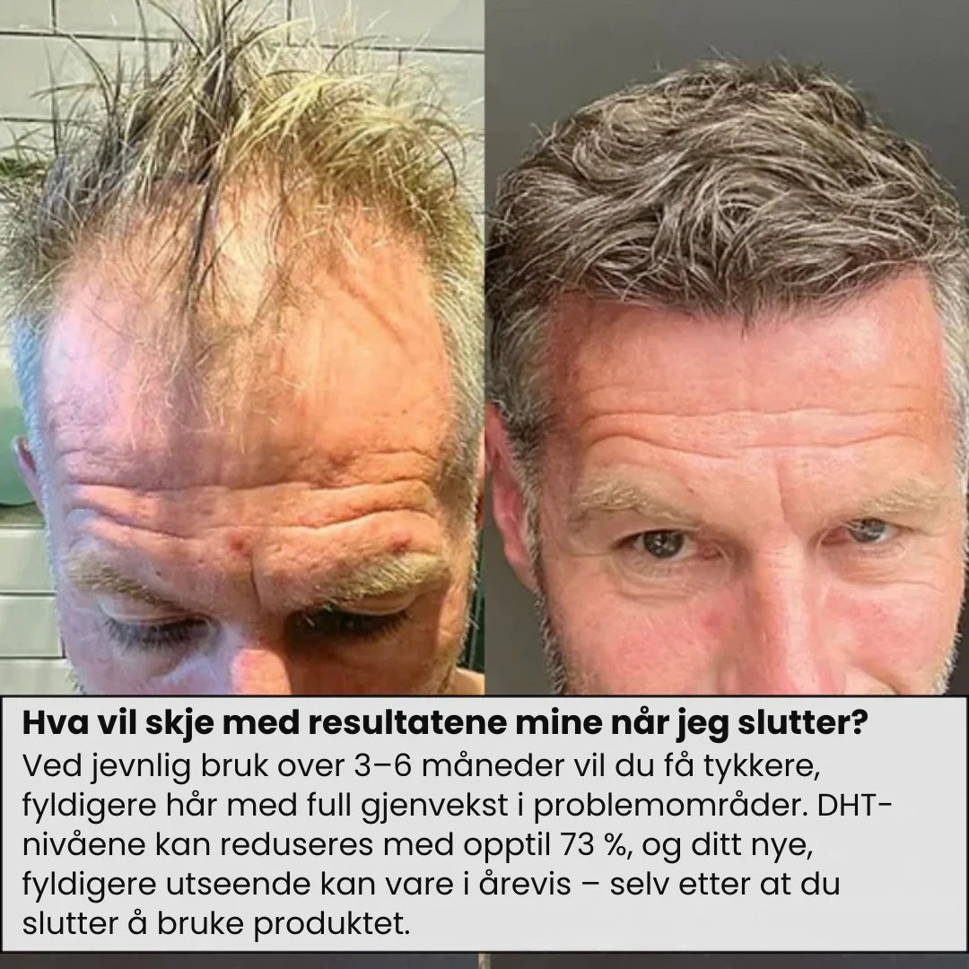 Produktbilde 6