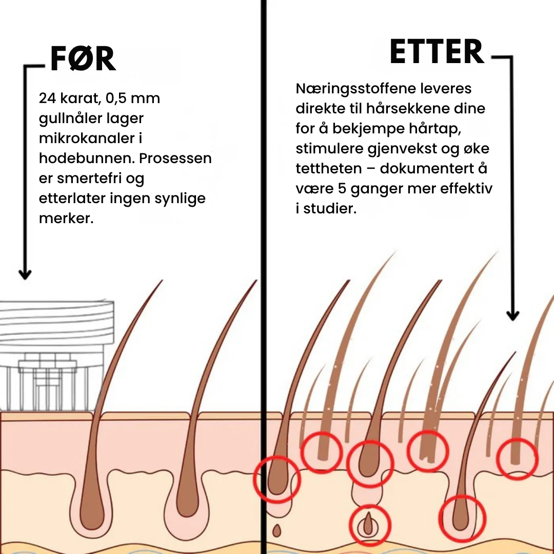 Miniatyr 2