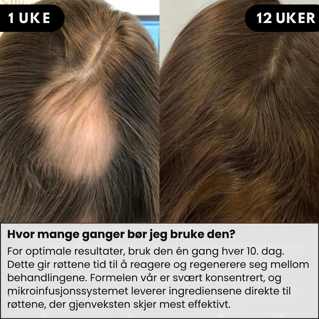 Produktbilde 3