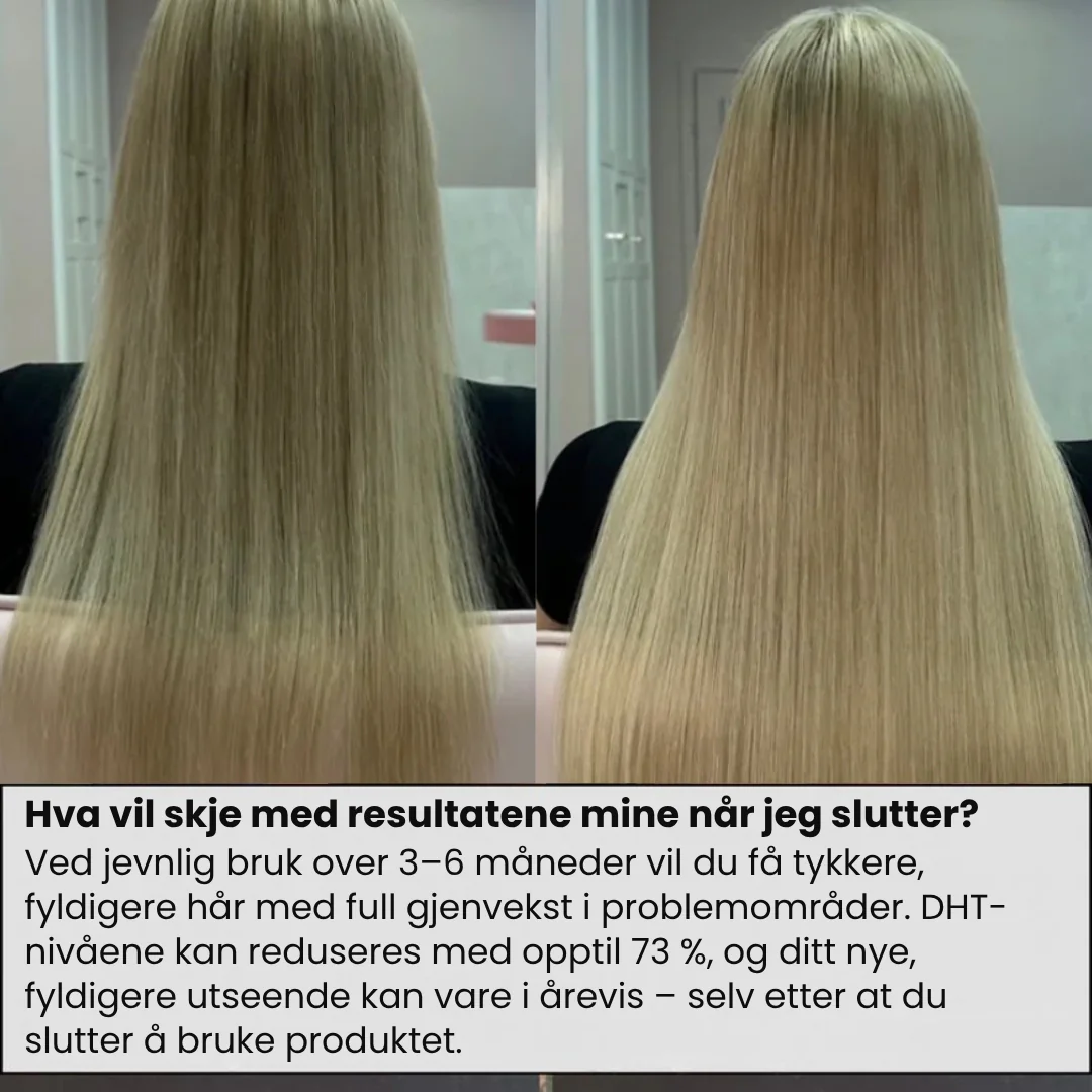 Produktbilde 5