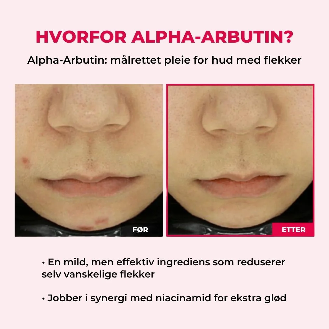 Produktbilde 9