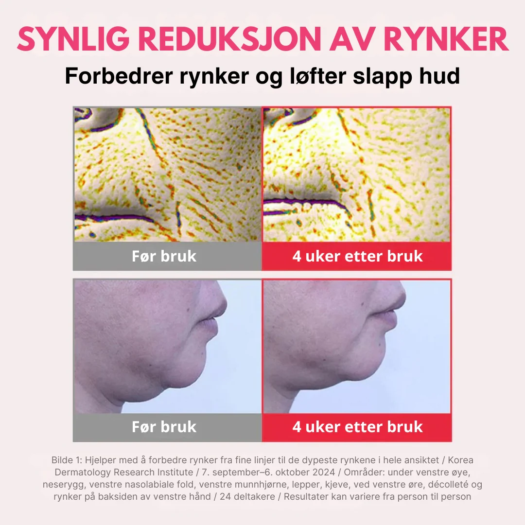 Produktbilde 4