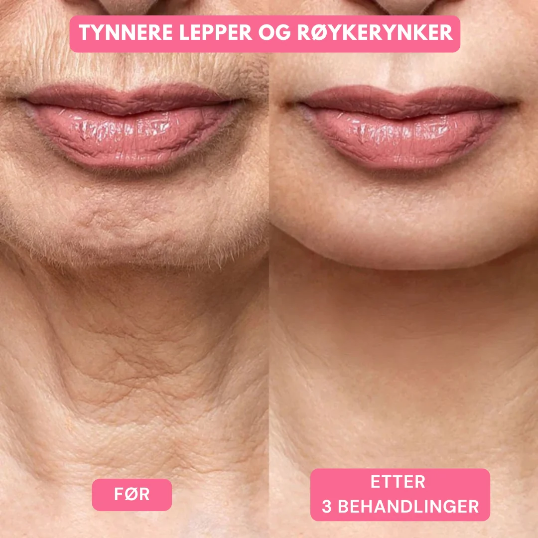 Produktbilde 10
