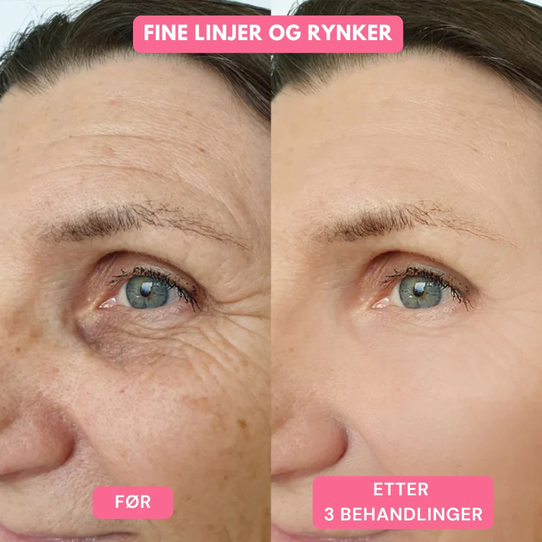 Produktbilde 8