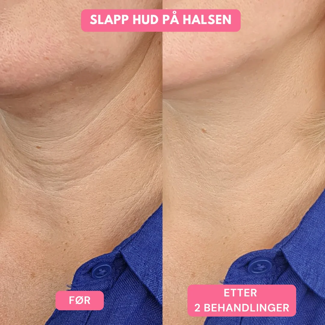 Produktbilde 9