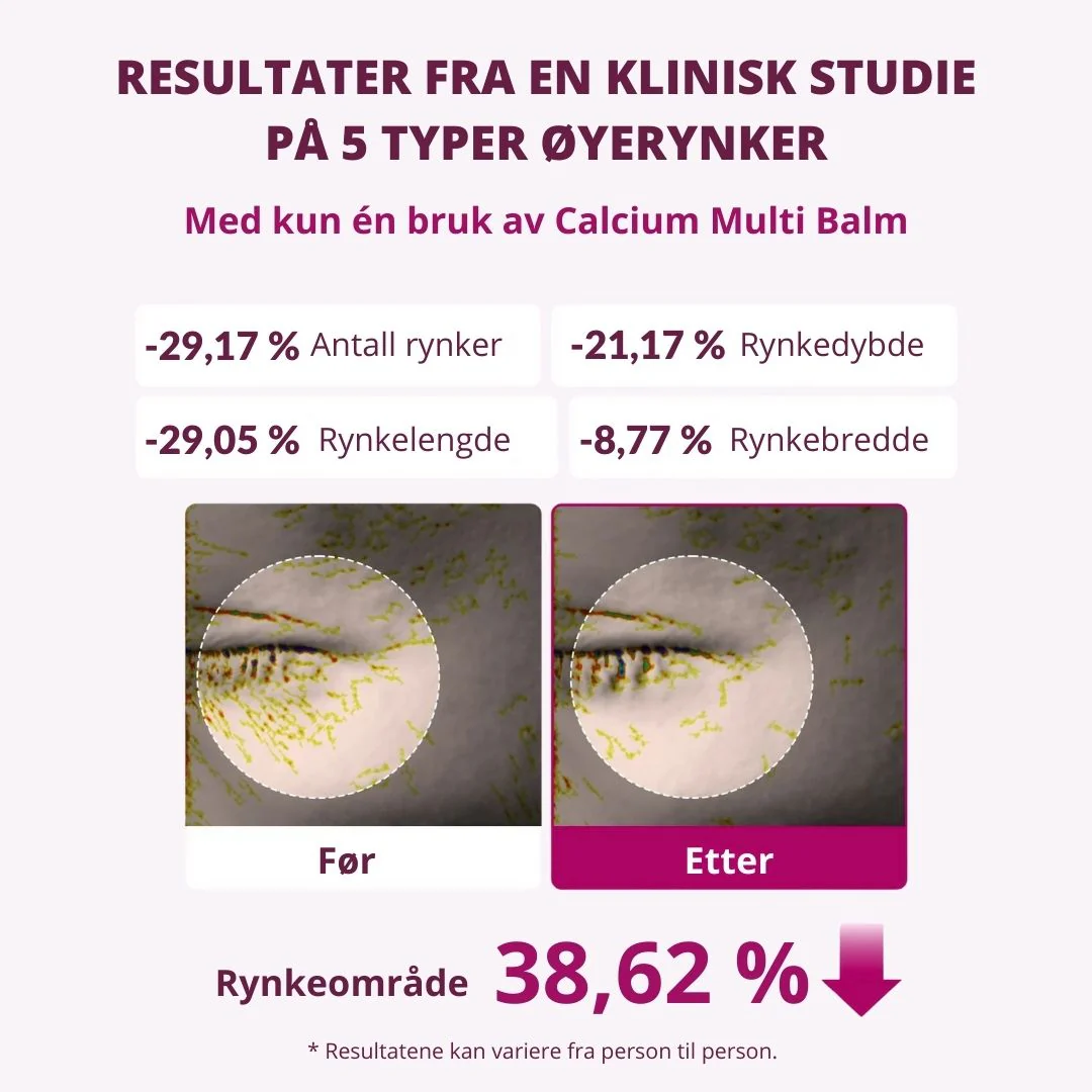 Produktbilde 11