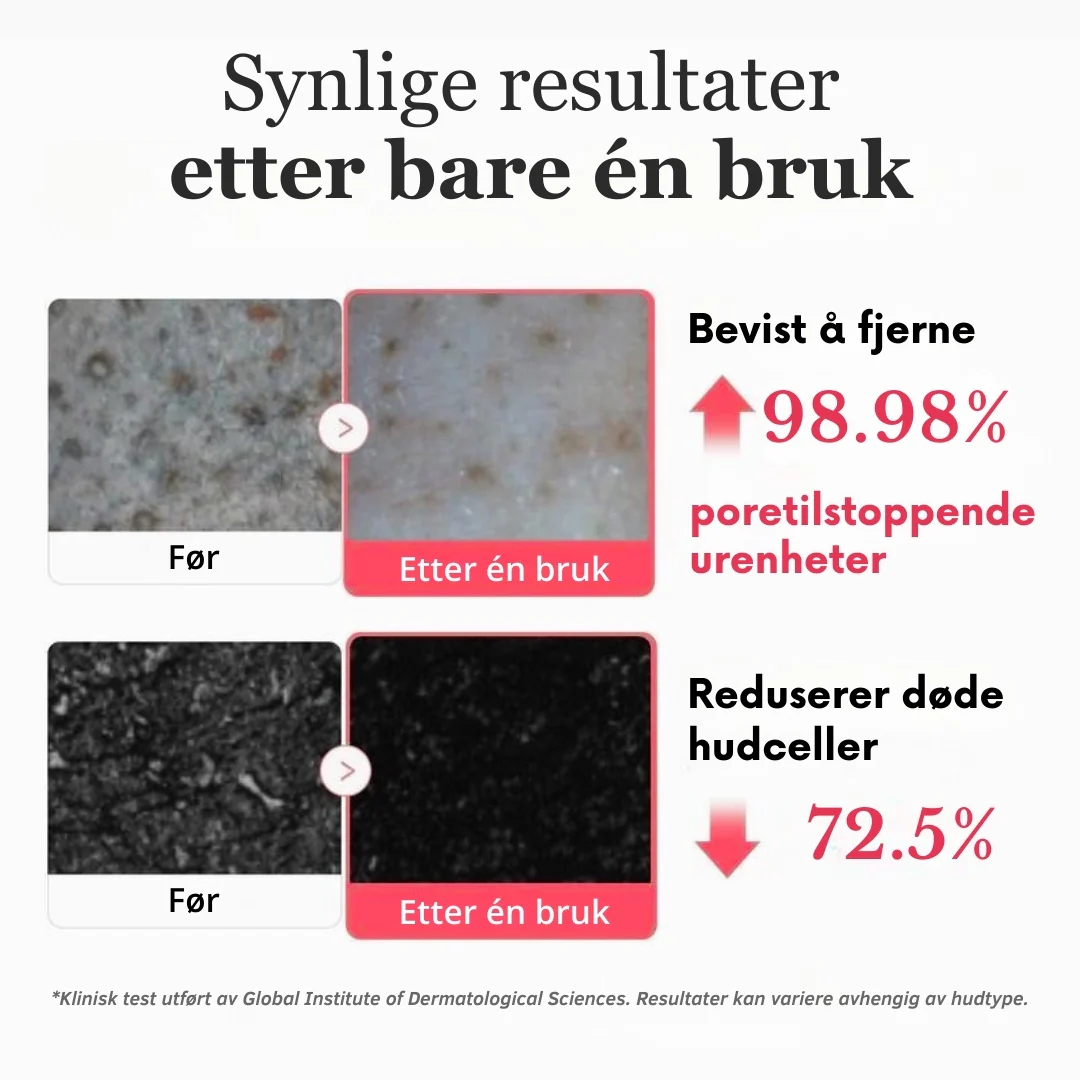 Produktbilde 5