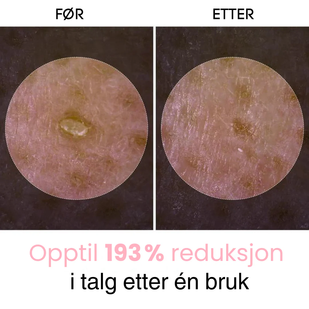 Produktbilde 5