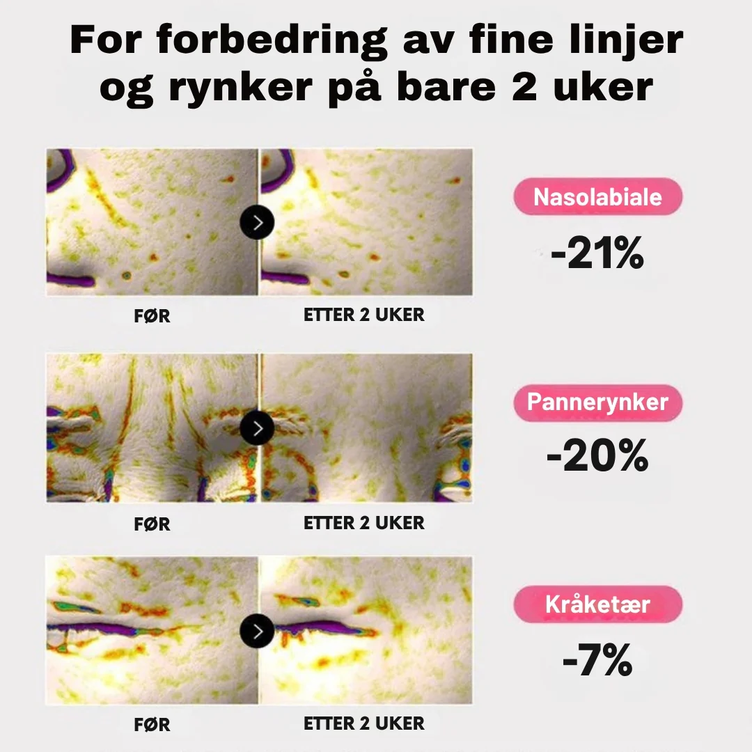 Produktbilde 14