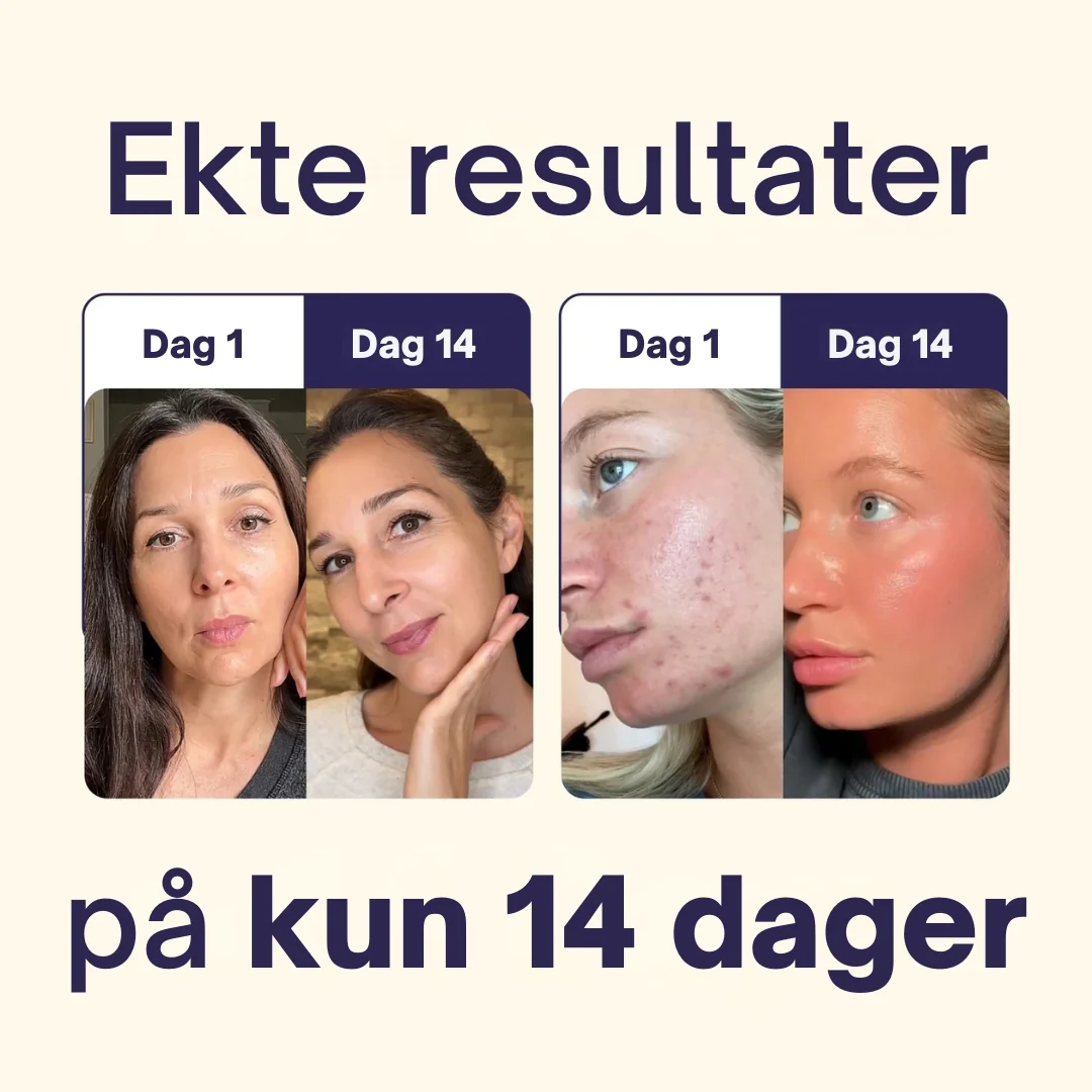 Produktbilde 3