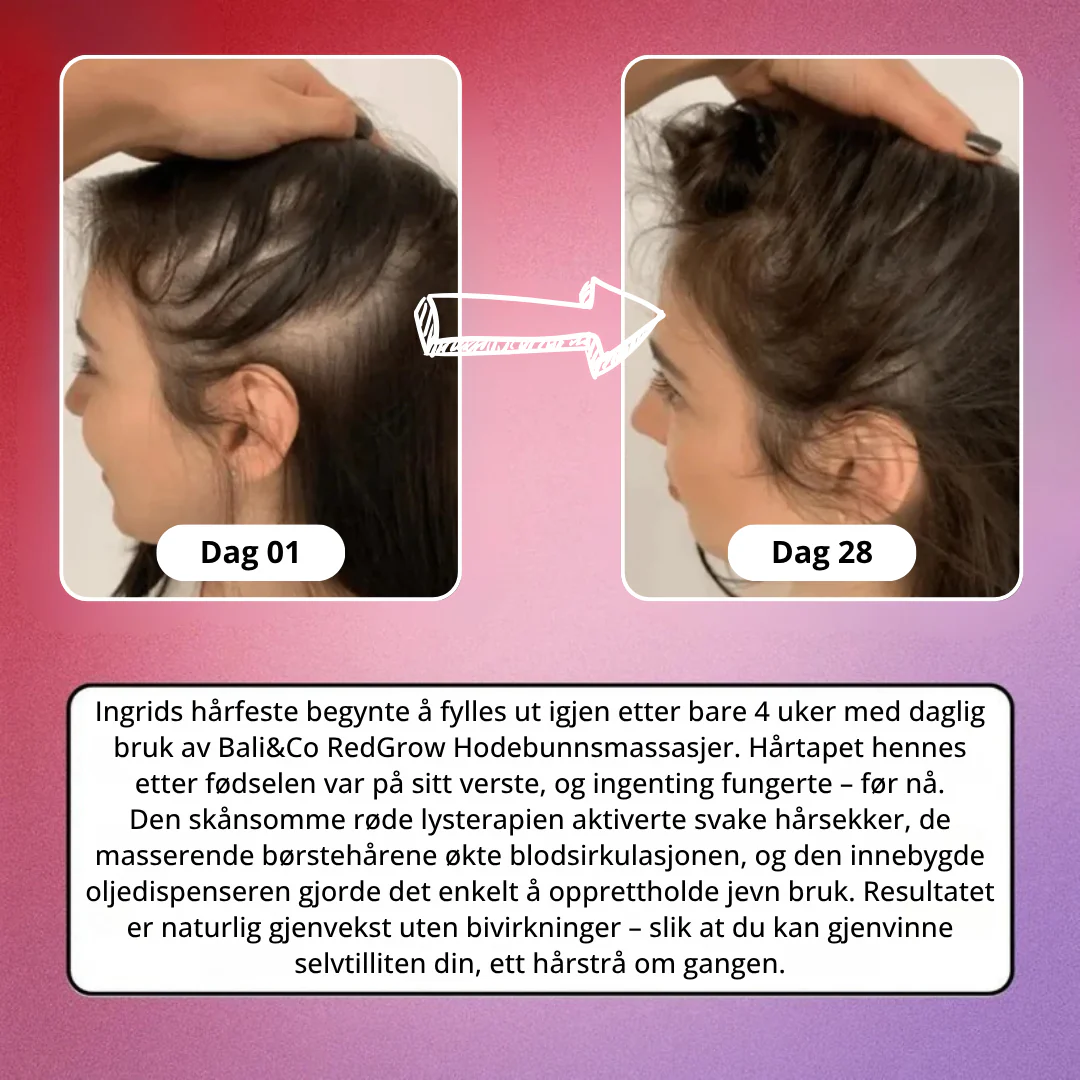Produktbilde 4